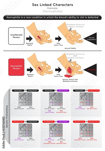 Sex Linked Characters Infographic Diagram example hemophilia bleeding wound clot coagulation factor hemophilic male female punnett square genetic probability heredity gene science education vector photo