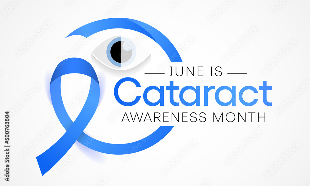 Cataract awareness month is observed every year in June, it is a dense, cloudy area that forms in the lens of the eye. Vector illustration. Cataract awareness month is observed every year in June, it is a dense, cloudy area that forms in the lens of the eye. Vector illustration.