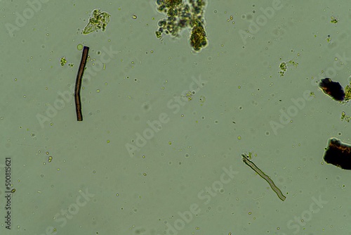 biological organisms under the microscopes in australia. living microorganisms photo