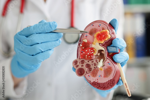 Photos Urologist pointing pen kidney structure on anatomical model