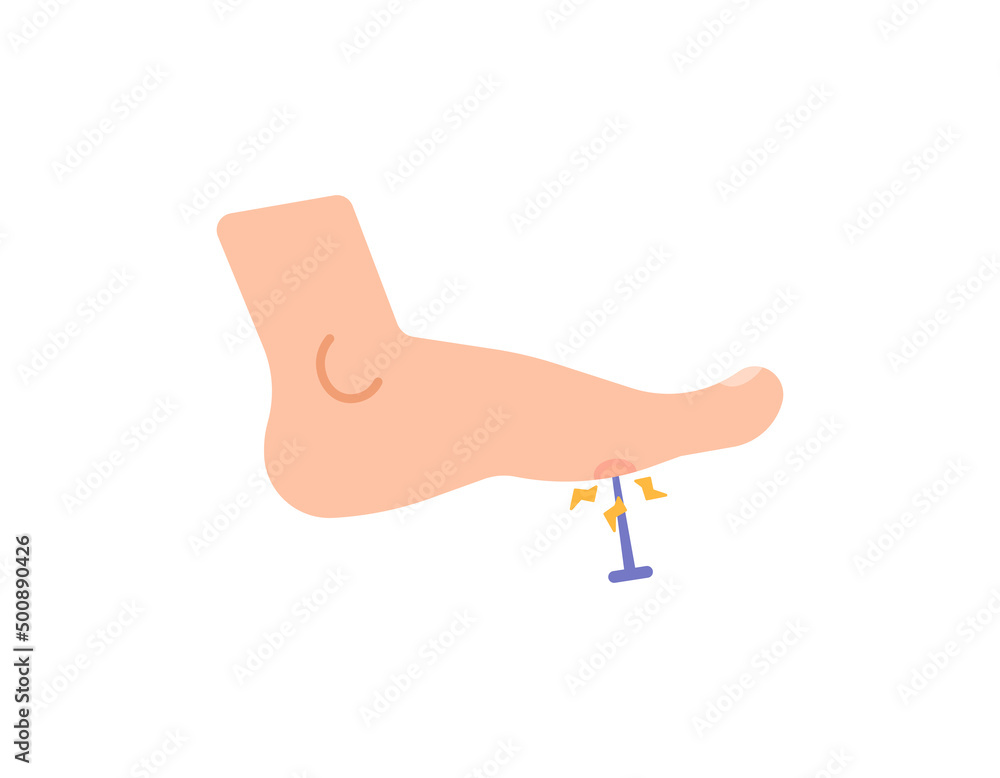 illustration of a nail pierced by a foot, stuck a nail in the leg