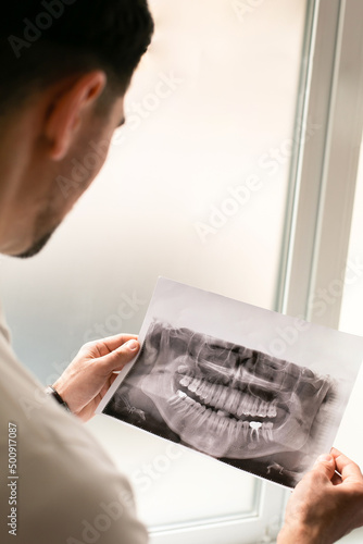 Dentist looking an X-ray of jaw with an implanted tooth . Dentist services concept