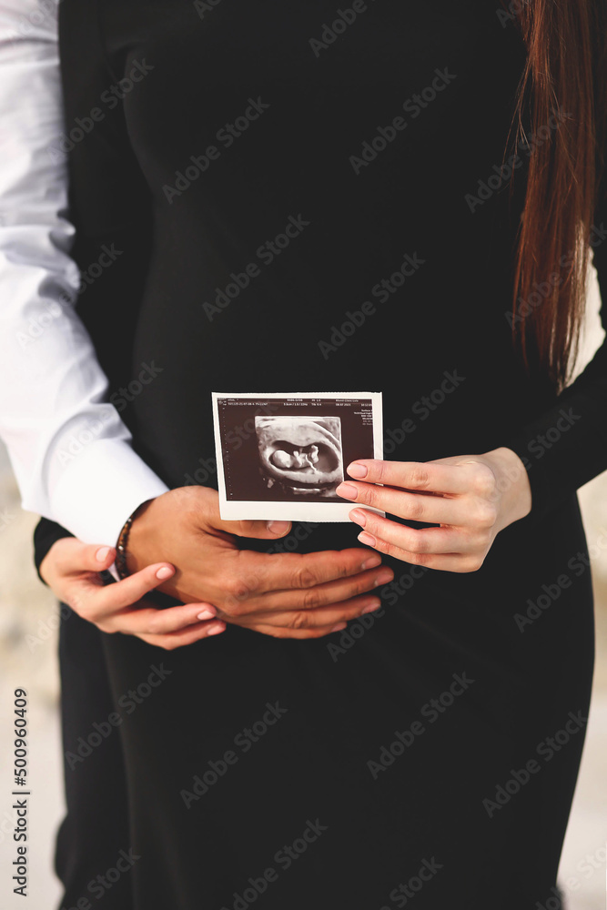 Close up photo of pregnant woman and her husband holding their hands on  pregnant belly and ultrasound photo of fetus. Family concept