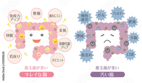 腸活イラスト　善玉菌が多い腸　悪玉菌が多い腸
