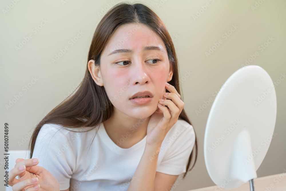 Dermatology, puberty asian young woman, girl looking into mirror, allergy presenting an allergic reaction from cosmetic, red spot or rash on face. Beauty care from skin problem by medical treatment. Dermatology, puberty asian young woman, girl looking into mirror, allergy presenting an allergic reaction from cosmetic, red spot or rash on face. Beauty care from skin problem by medical treatment.
