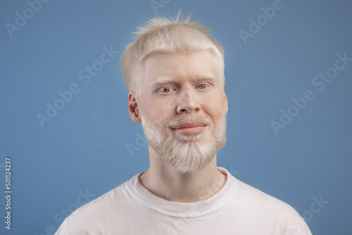 Skin abnormality concept. Portrait of bearded handsome albino guy posing to camera over blue studio background