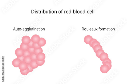 Red blood cell morphology. Distribution of red blood cell. Auto-agglutination and Rouleaux formation.