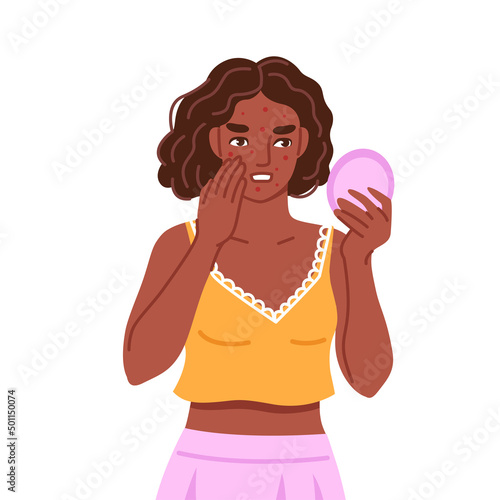 Acne, spotty skin. Black woman looking in round mirror. Skincare, skin problems, pimples concept. Symptom of pms. Hand drawn cartoon character. Vector flat isolated illustration