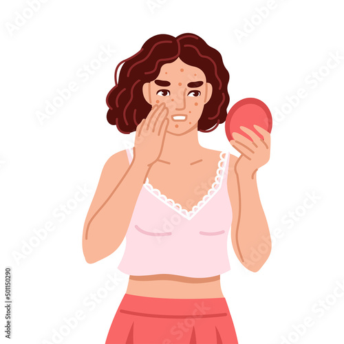 Acne, spotty skin. Woman looking in round mirror. Skincare, skin problems, pimples concept. Symptom of pms. Hand drawn cartoon character. Vector flat isolated illustration