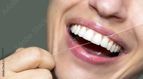 close up woman's mouth with large smile and big white front teeth is cleaning with dental floss. dental care and hygiene concept. happy excited girl for advertising banner, dental services
