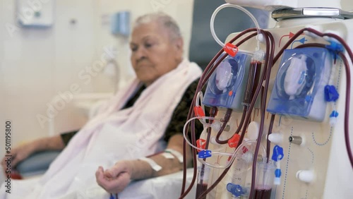 Hardware Hemodialysis. An elderly person, a patient connected to a blood assessment machine. photo