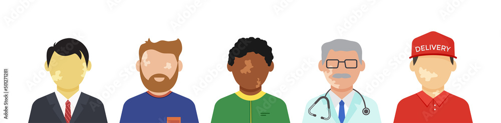 Character with vitiligo vector icon, pigmentation skin on different people, portrait of international men. World Vitiligo Day illustration Character with vitiligo vector icon, pigmentation skin on different people, portrait of international men. World Vitiligo Day illustration