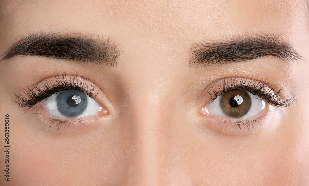 Obraz premium Woman with different colors of eyes, closeup. Heterochromia iridis