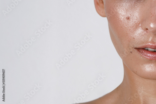 close-up girl with sweaty skin on her face and excessive oily sheen, excessive sweating, hyperhidrosis disease