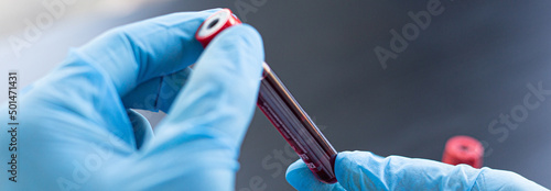 Scientists or doctors collect blood samples from new strains of virus patients for analysis and vaccination in the research laboratory, Vaccine research to eliminate viruses concept.