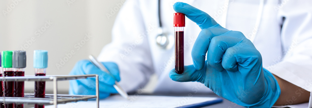 Scientists or physicians analyze the blood sample in vitro to prepare a vaccine against a new strain of viruses, Vaccine Research and Science concept. Scientists or physicians analyze the blood sample in vitro to prepare a vaccine against a new strain of viruses, Vaccine Research and Science concept.