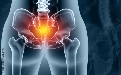 Painful Hip skeleton, x-ray view, Medical concept. 3d illustration