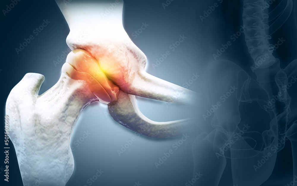 Human shoulder joint pain, xray view, shoulder ligament tendinitis, shoulder muscle strain. 3d