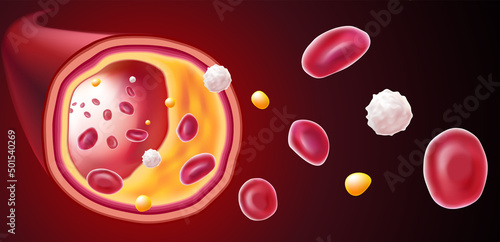 3D Illustration of red blood cells, white blood cells and cholesterol clogging the cause of death. medical use science, education photo