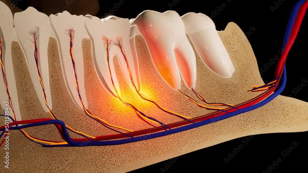 Toothache. Anatomical detailed section of the teeth. Nerve inflammation ...