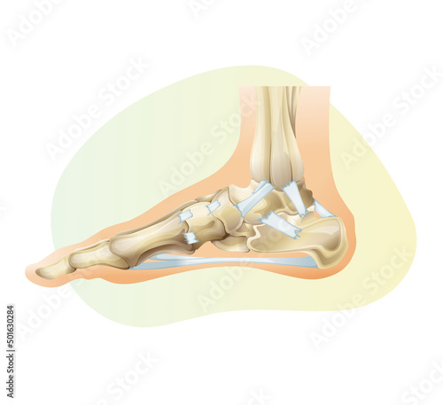The ankle joint with Ligament - Stock Illustration
