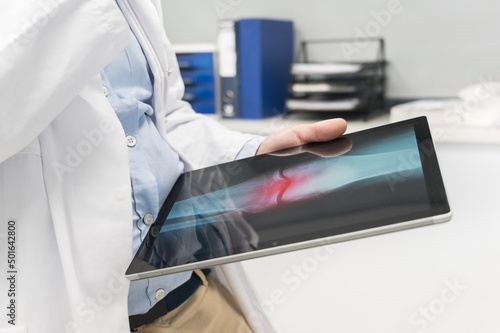 Unrecognizable Doctor is checking x-ray image at computer tablet  close up. Doctor at work in a hospital. Medicine and healthcare concept. High quality photography.