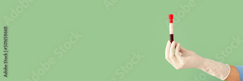 Doctor's hand holding test ...