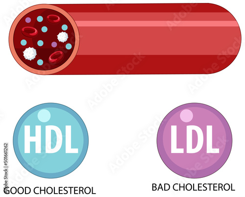 Types of Cholesterol HDL and LDL
