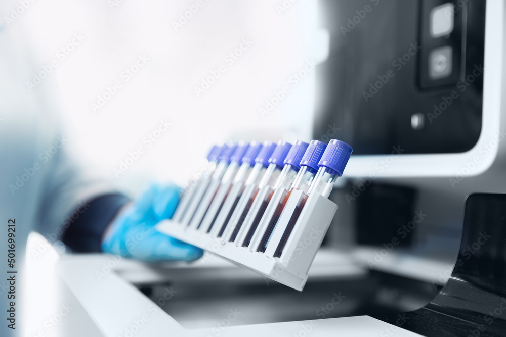 Medical robot machine for biochemical automatic testing blood laboratories Medical robot machine for biochemical automatic testing blood laboratories