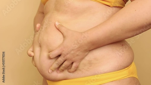 Wallpaper Mural Side view of unrecognizable fat plus-size woman wearing yellow bra, bikini, squeezing excess subcutaneous fat of stomach, massaging on beige background. Body positive, weight loss, health problems. Torontodigital.ca
