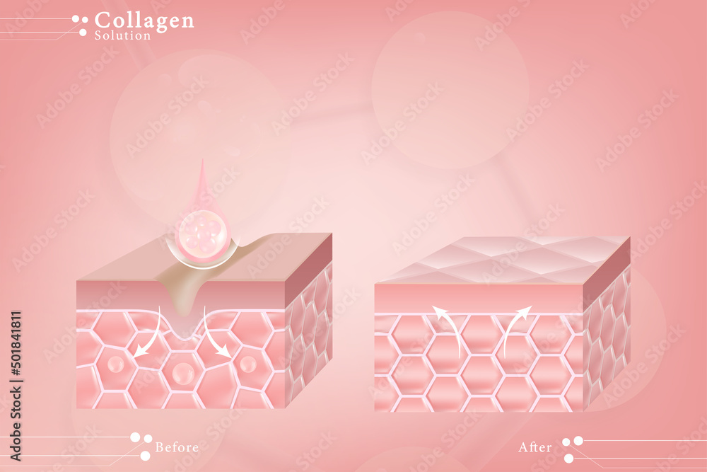 Hyaluronic acid before and after skin solutions ad, pink collagen serum drops over pink skin cells with cosmetic advertising background ready to use, illustration vector.