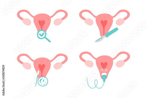 Gynecology icons set. Ultrasound, check up, bacteria test, gynecological surgery.