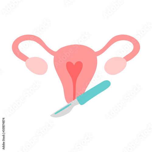 Gynecological surgery, problem with reproductive system. Gynecology. Uterine, ovaries and scalpel.