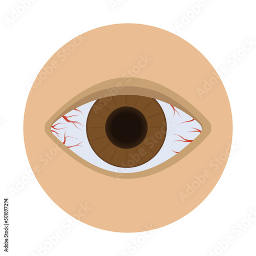 redness of the eye