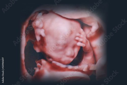 Fotografia 胎児の3D写真