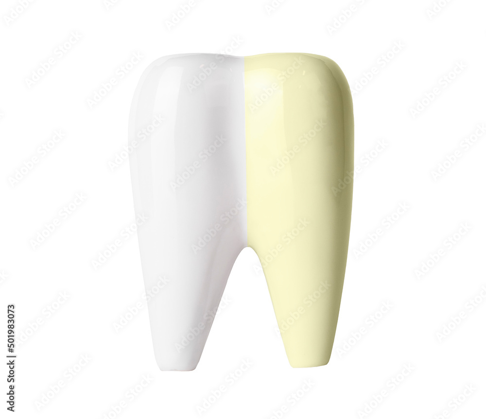 Tooth whitening before and after isolated on white background. Professional teeth cleaning and bleaching, dental care and oral hygiene concept. High quality photo Tooth whitening before and after isolated on white background. Professional teeth cleaning and bleaching, dental care and oral hygiene concept. High quality photo
