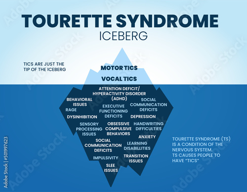 The vector of Tourette syndrome iceberg has its motor and vocal tics on the surface and hides the life conditions or causes of the tic underwater. The iceberg illustration is for syndrome analysis  