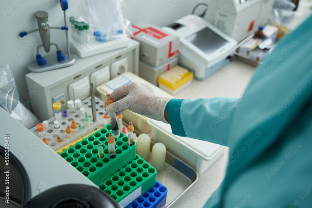 Woman working in laboratory with blood samples Woman working in laboratory with blood samples