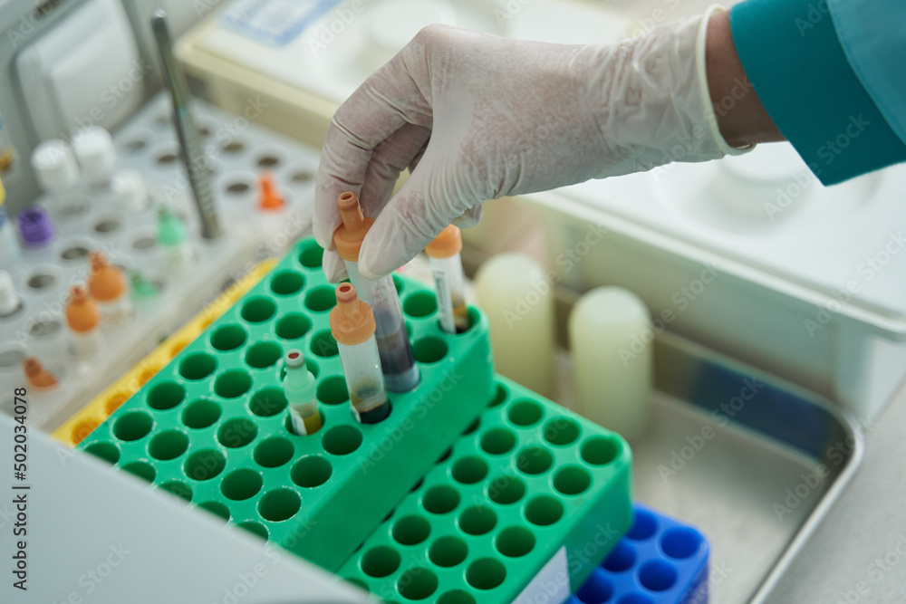 Woman arranging tubes with blood in laboratory Woman arranging tubes with blood in laboratory