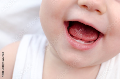 Baby mouth close-up. Infant primary dentition. Children healthcare and soothing concept photo