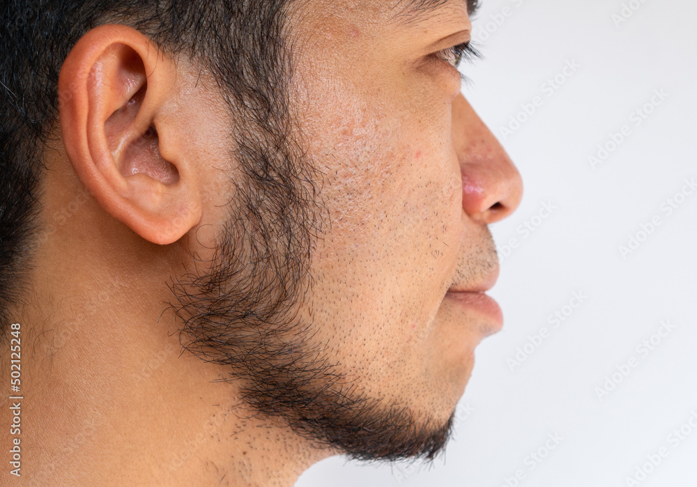 Side view of Asian man face with beard grows on a part of his face