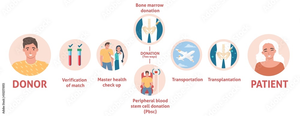 Bone marrow donation medical poster info graphic - obrazy, fototapety, plakaty 