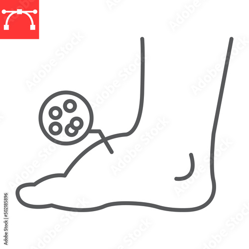 Leg edema line icon, diabetic and foot, leg swelling vector icon, vector graphics, editable stroke outline sign, eps 10. photo