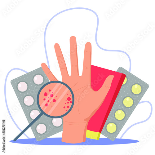 Problems with the skin of the palms. Dermatologist, medicines for allergies, eczema or dermatosis. Palm with inflammation on a white background.