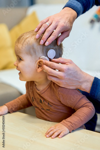 Shot of a deaf child with cochlear implants photo