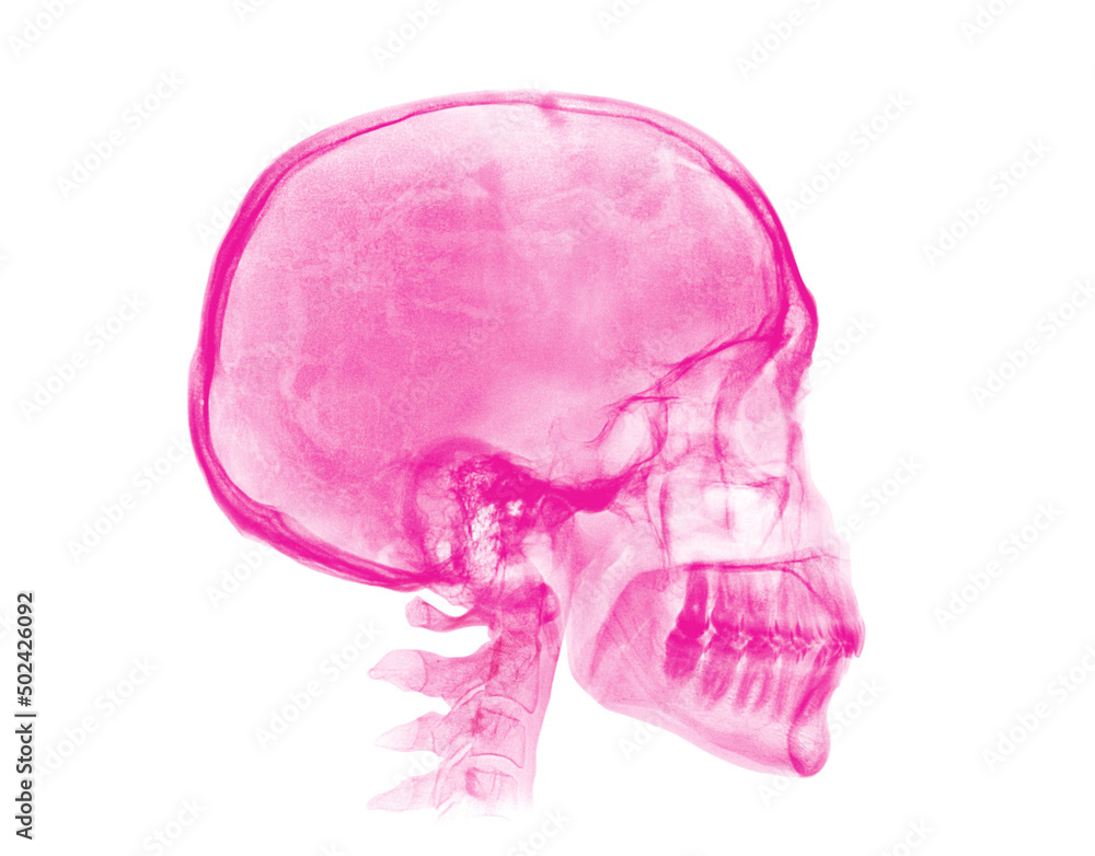 Human skull. Pink X-ray image on white background Human skull. Pink X-ray image on white background