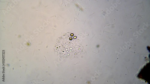 microorganisms in a drop of water from a freshwater lake