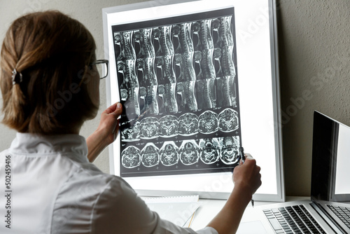 Doctor examining the result of cervical spine MRI.