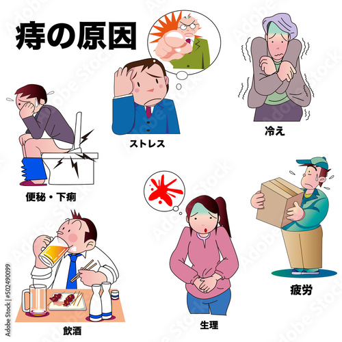 痔の原因や注意事項の解説イラスト