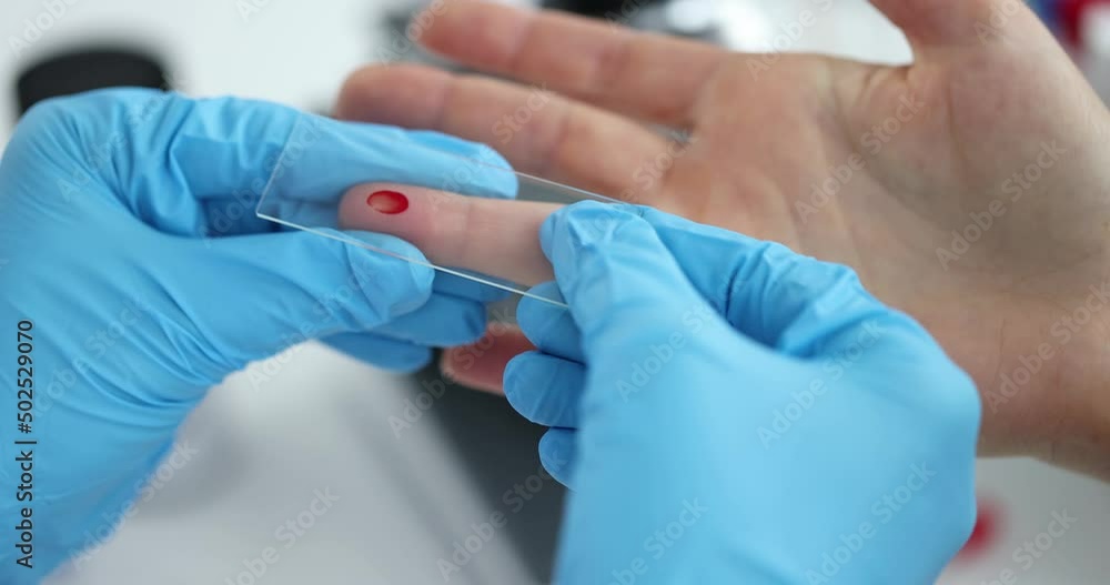 Doctor takes blood from finger for analysis closeup Doctor takes blood from finger for analysis closeup